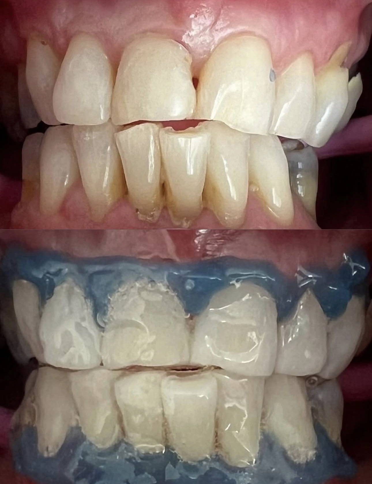 Client 1 before and after