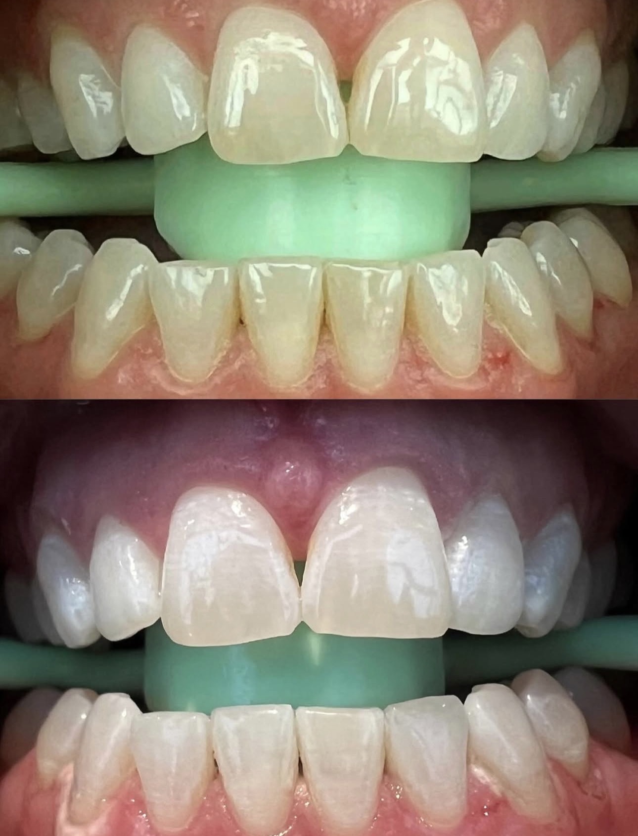 Client 3 before and after