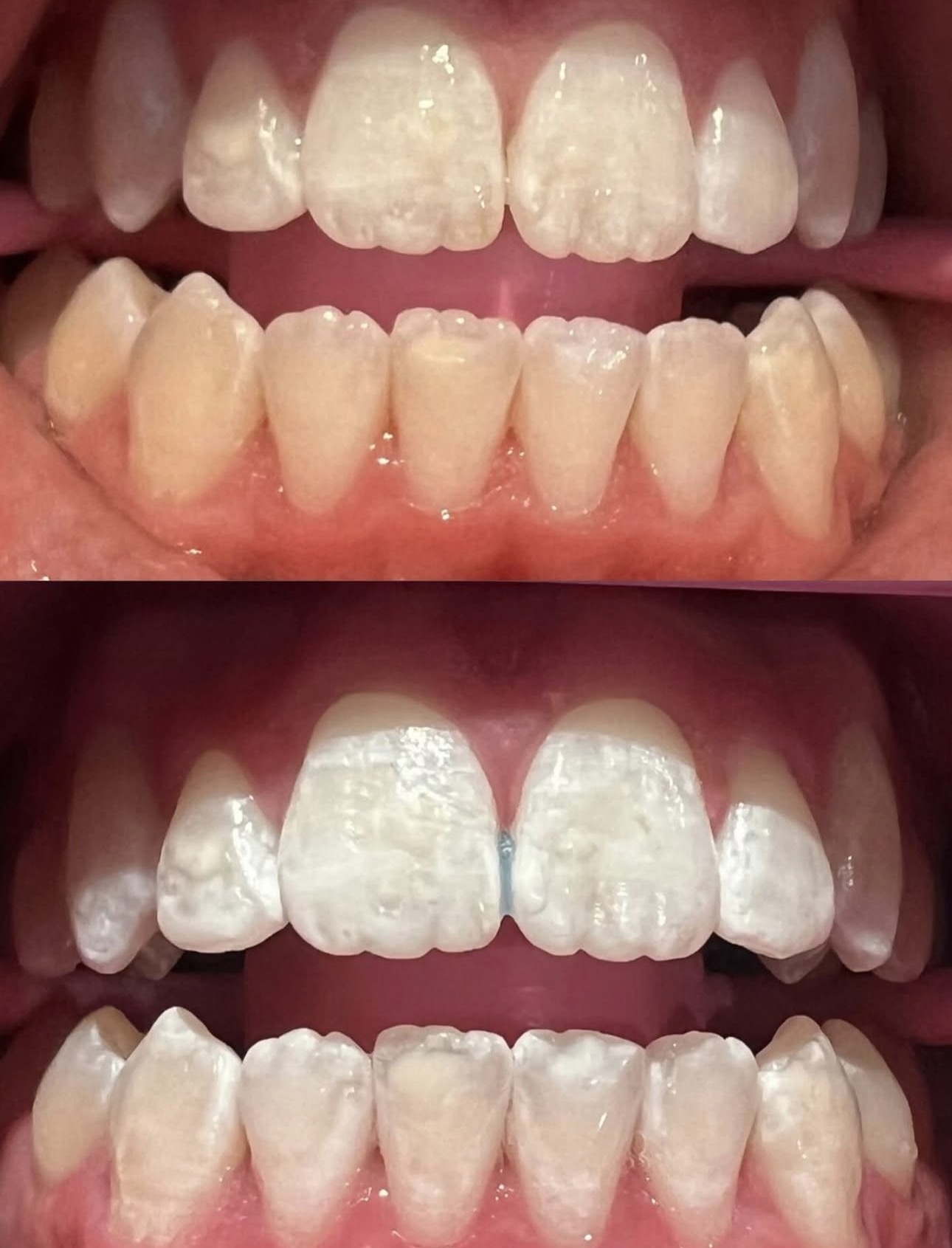 Client 4 before and after