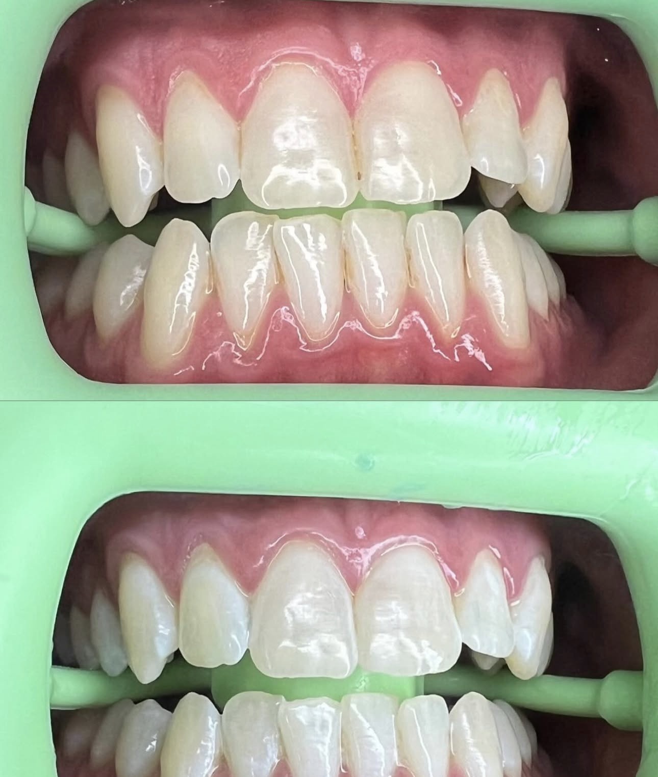 Client 5 before and after